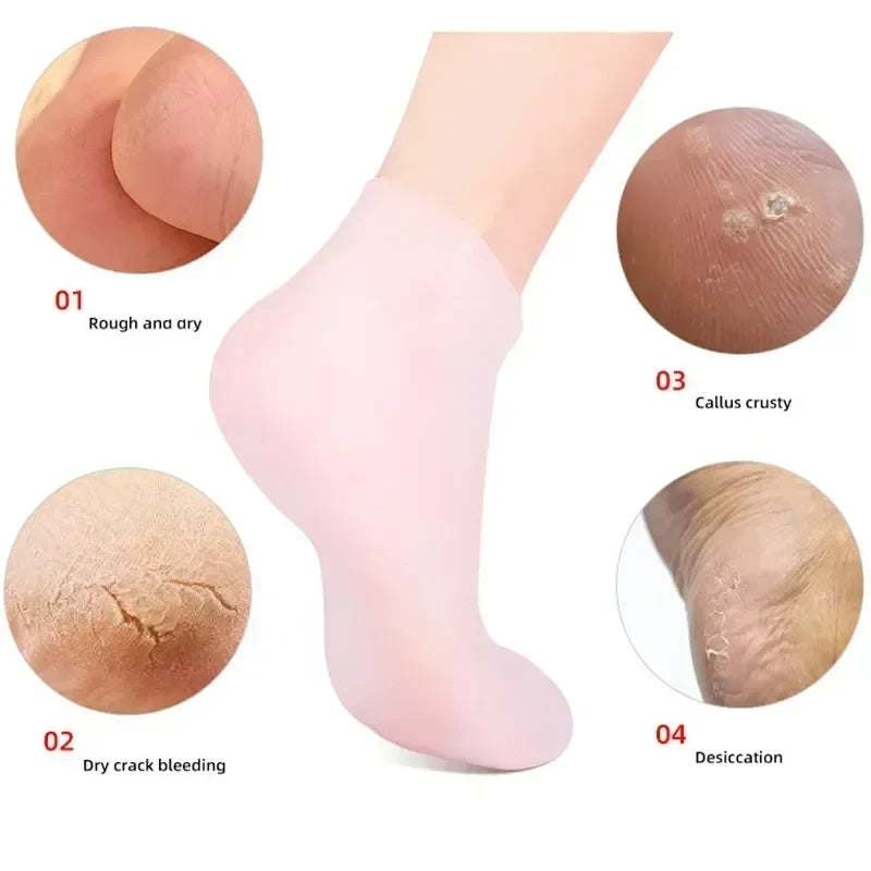 2PCS Silicone Moisturizing Foot Socks for Dry Cracked Heels – Reusable Heel Repair Gel Socks, Spa Pedicure Foot Care for Men & Women