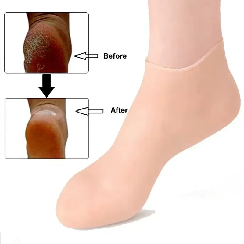 2PCS Silicone Moisturizing Foot Socks for Dry Cracked Heels – Reusable Heel Repair Gel Socks, Spa Pedicure Foot Care for Men & Women